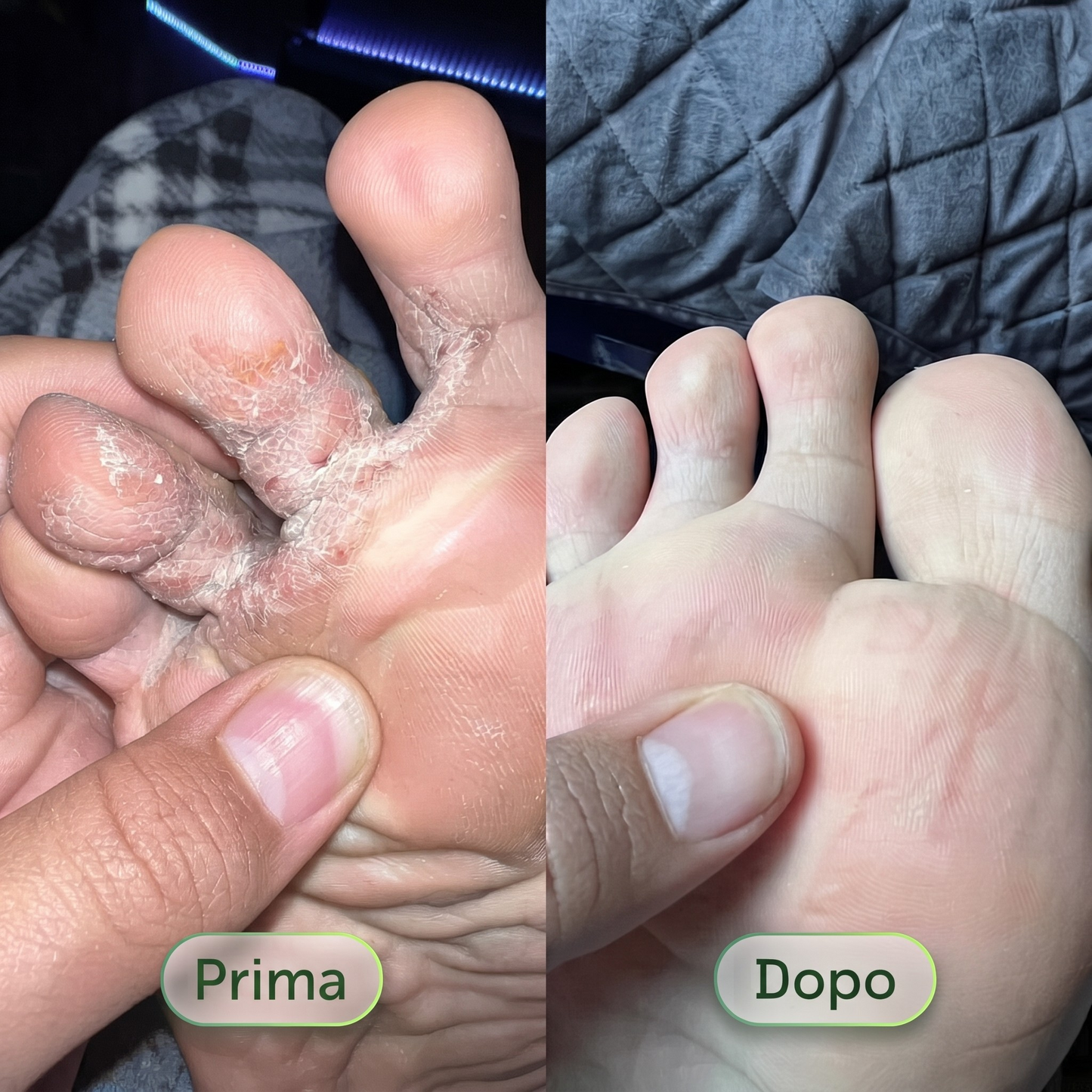 Germa® Purifying Antifungal Soap