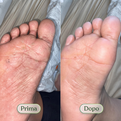 Germa® Purifying Antifungal Soap