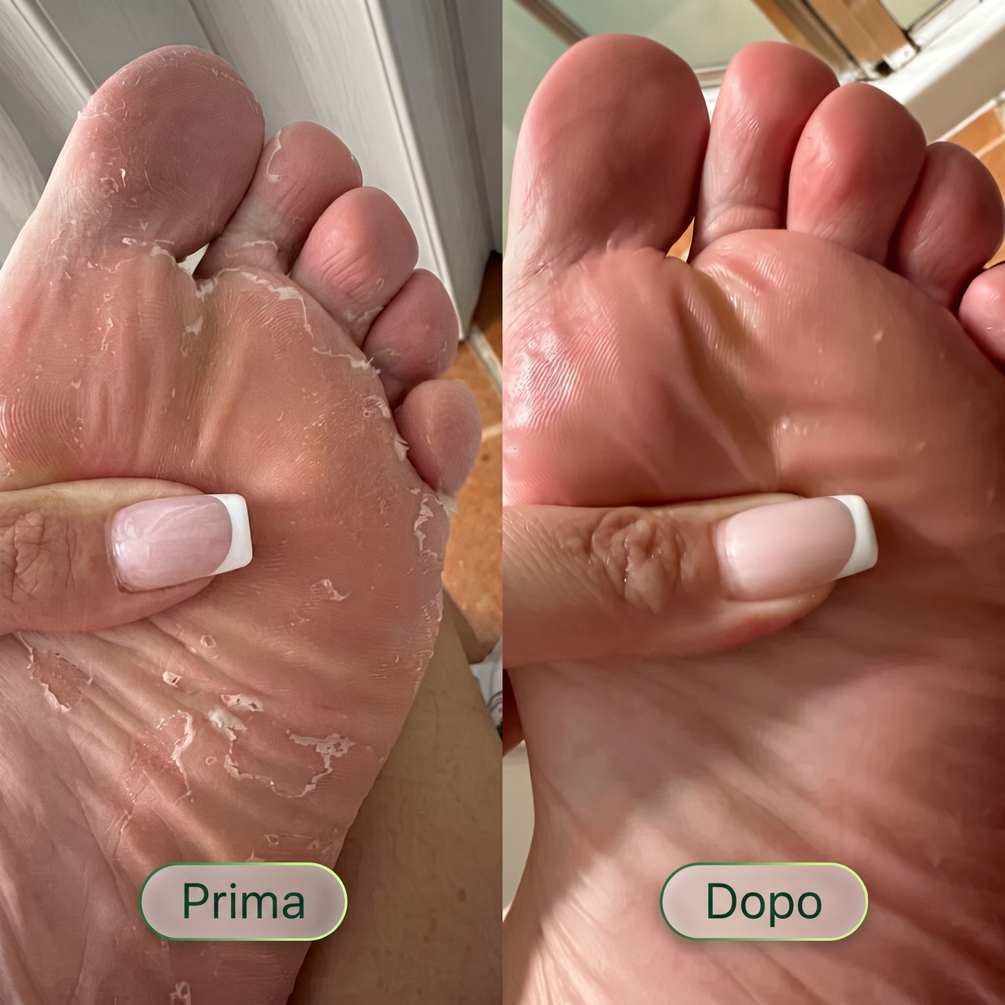 Germa® Purifying Antifungal Soap