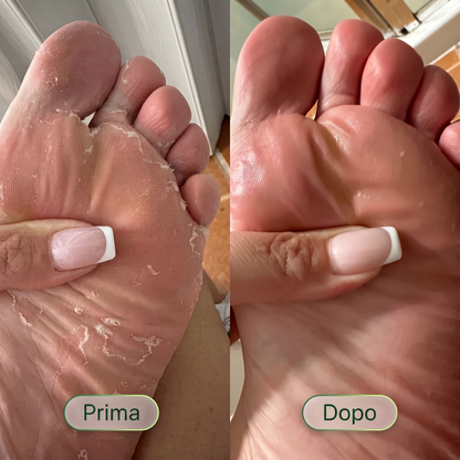 Germa® Purifying Antifungal Soap