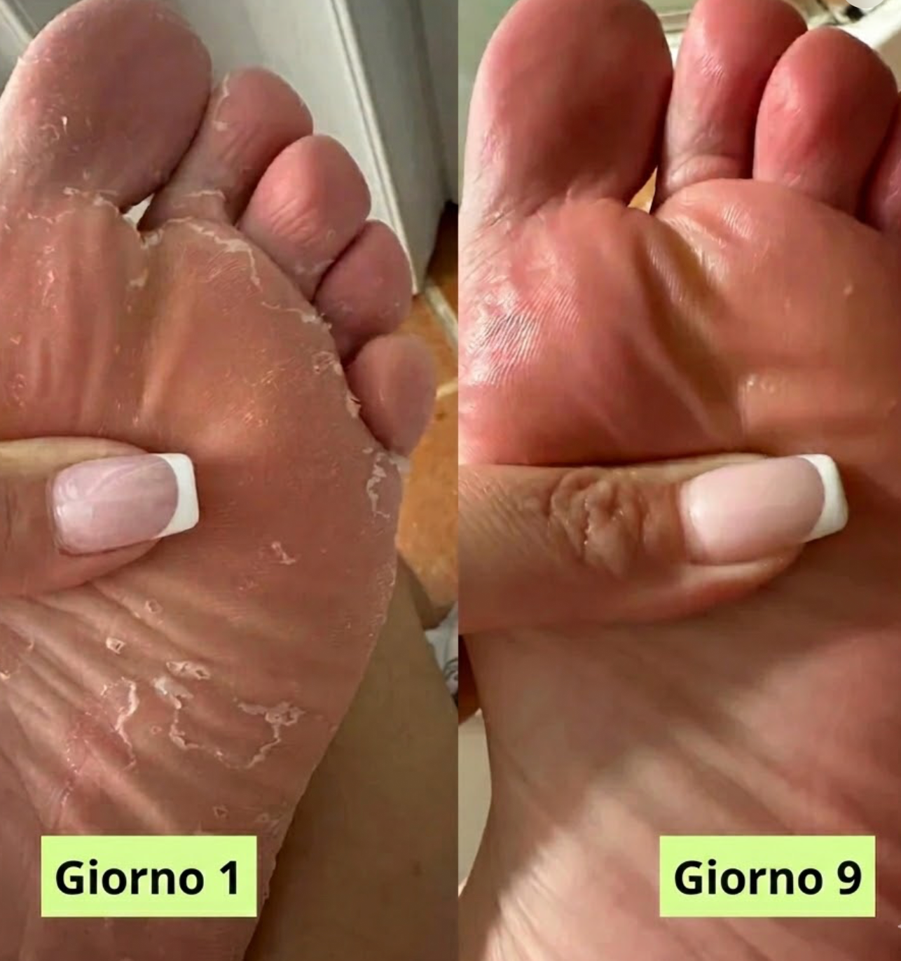 Germa® Sapone Purificante Antifungino