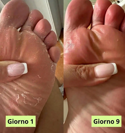 Germa® Sapone Purificante Antifungino