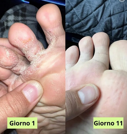 Germa® Sapone Purificante Antifungino